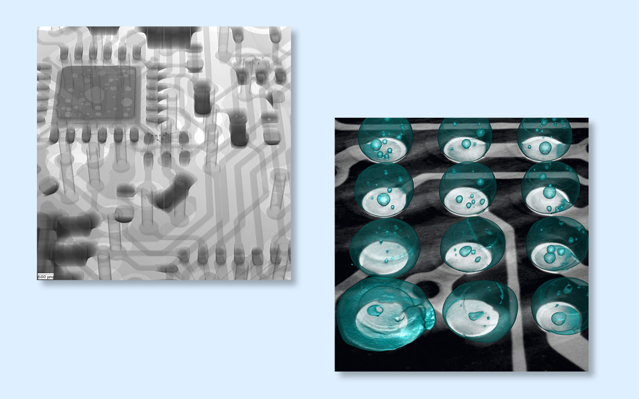 4. 2D срещу 3D CT рентгенови лъчи Кое наистина ви трябва?