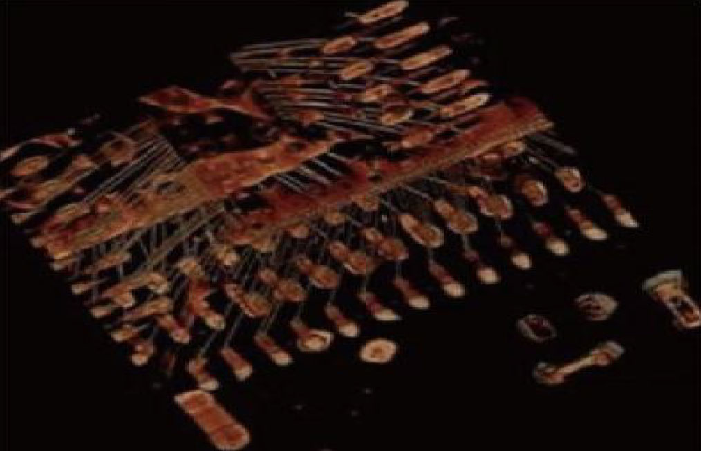 IC 3D CT откриване